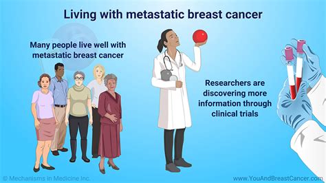 Understanding Metastatic Breast Cancer