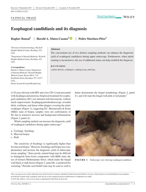PDF Esophageal Candidiasis And Its Diagnosis