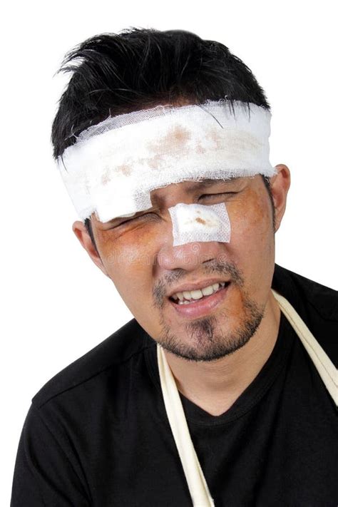 Face Of Beaten Man Feels Hurt Stock Image Image Of Damage Funny