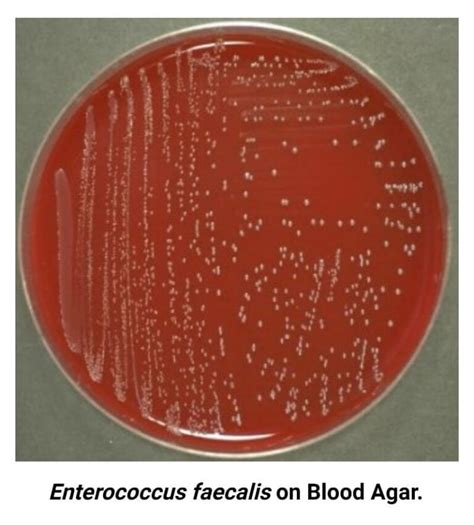 Enterococcus Faecalis A Comprehensive Guide