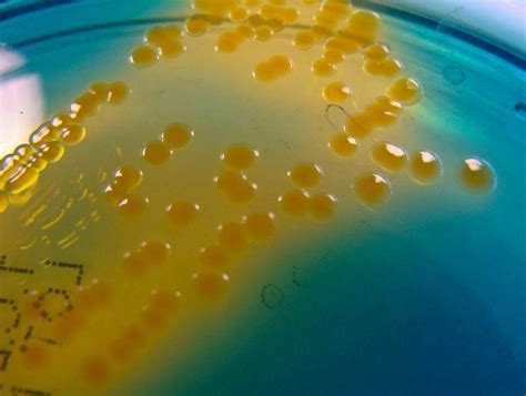 Vibrio Cholerae On Tcbs Agar Medical Laboratories