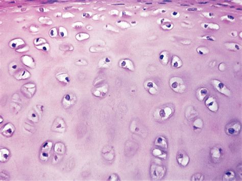 Histology Gallery Hyaline Cartilage Tissue Types Cartilage