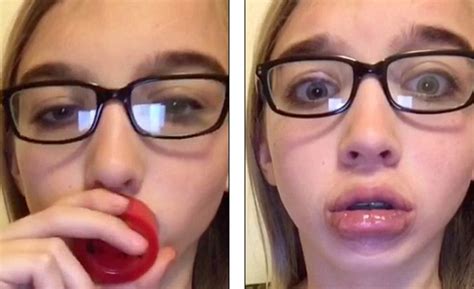 Teens Are Sucking Shot Glasses In An Attempt To Get Big Lips Like Kylie Jenner And The Results
