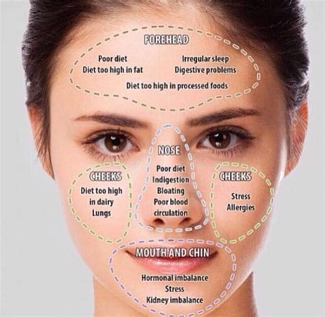 Pin On Acne Face Mapping