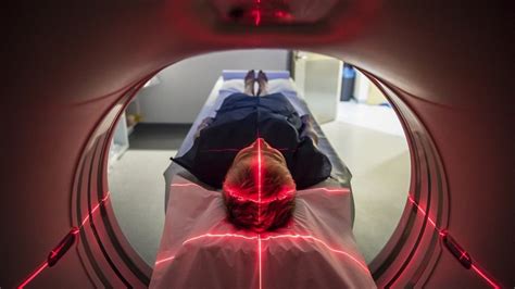 Radiation From Ct Scans Could Minimally Increase Cancer Risk