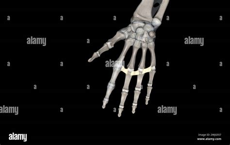The Deep Transverse Metacarpal Ligament Connects The Palmar Surfaces Of