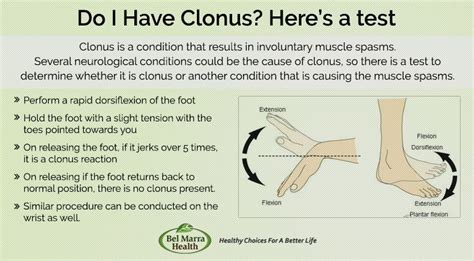 The abductor digiti minimi (abductor minimi digiti. What is Clonus? Causes, Tests and Treatments | Occupational therapy kids, Occupational therapy ...