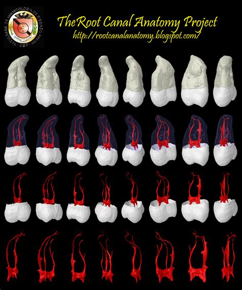 Maxillary Molar Root Anatomy
