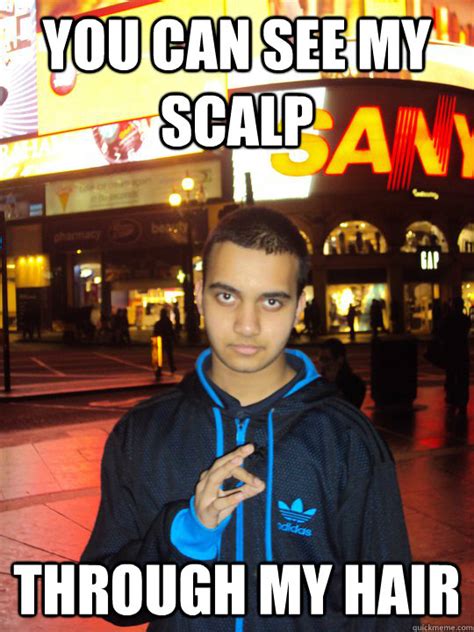 You Can See My Scalp Through My Hair Weird Ahmed Quickmeme