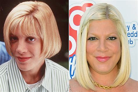 Tori Spelling Nose Job Plastic Surgery Before And After Photos Vrogue