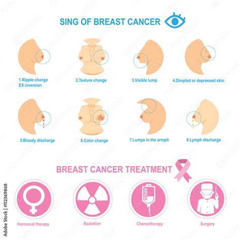 Breast Cancerbreast Deformity Breast Cancer Info Graphics In The