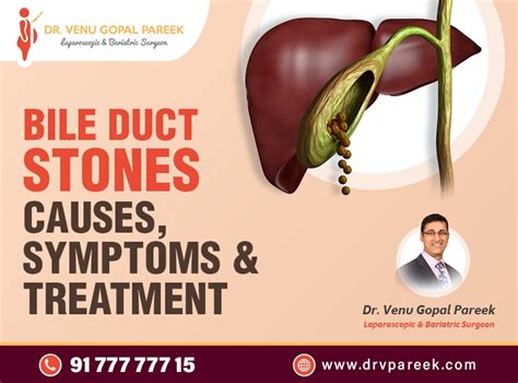 Bile Duct Stones Causes Symptoms And Treatment