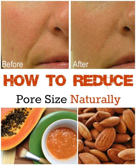 How To Reduce Pore Size Naturally Reduce Pore Size Reduce Pores Diy