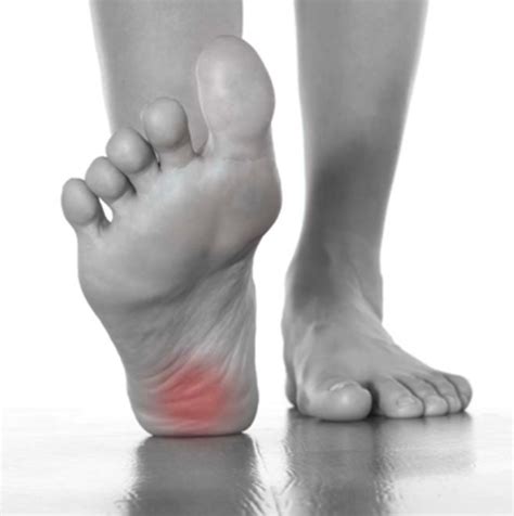 Suffering From Heel Pain 6 Easy Treatments To Help Podiatry First