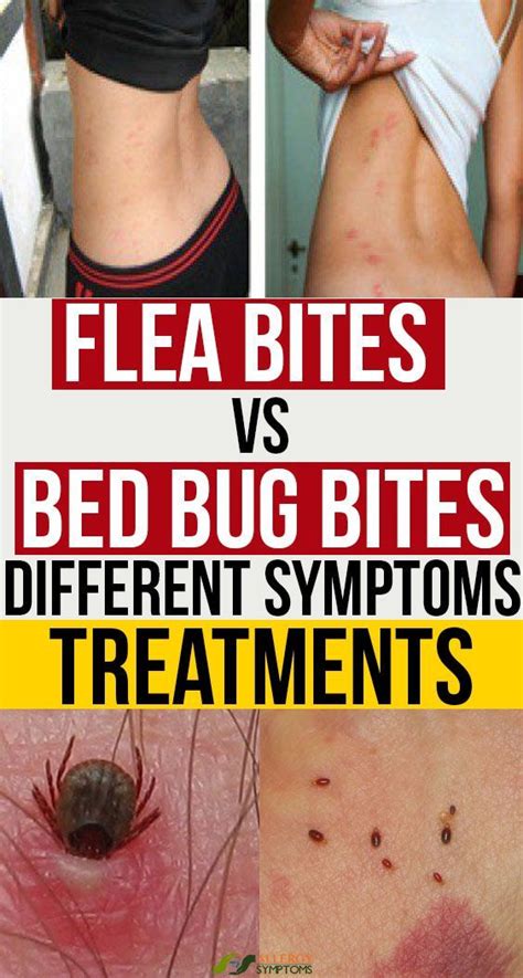 Bed Bug Flea Bites On Humans Bed Design