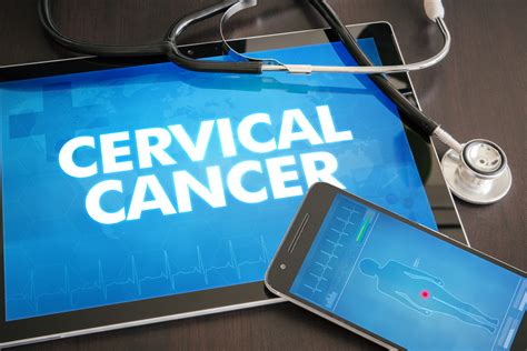 New Treatments Clinical Trials At Hollings Offer Hope To Cervical Cancer Patients Musc