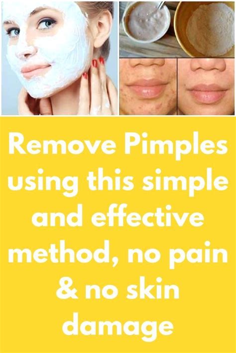 Pin On How To Get Rid Of Pimples