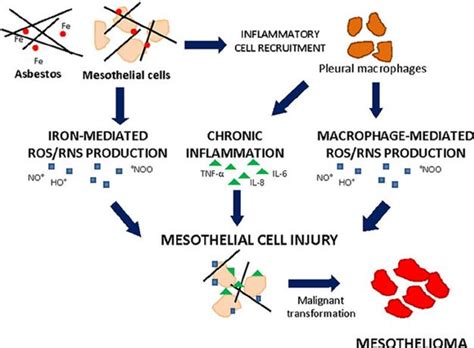 The seer database, however, does not group cancers by ajcc tnm stages(stage 1, stage 2, stage 3, etc.). Figure 2: Asbestos-induced cell injury leading to ...