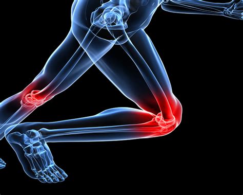 Innen, außen, vorne oder hinten am knie. Schmerzen im Knie - was kann helfen | Schmerz, Anatomie ...