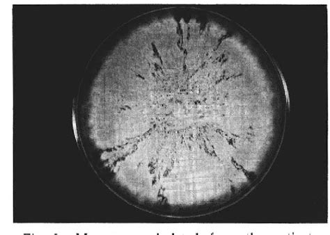 Figure 3 From A Case Of Tinea Scroti Due To Microsporum Gypseum