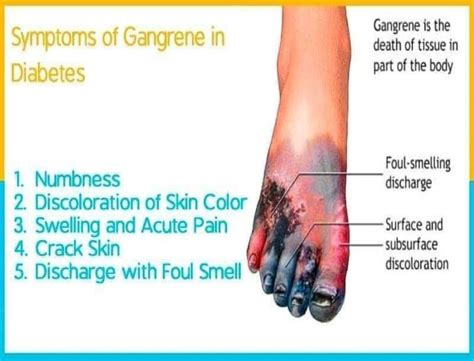 Gangrene Nurse Info