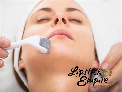 Before Undertaking Microneedling Know This Lipstick Empire Laserspa