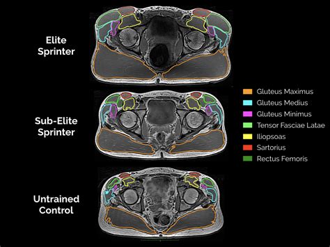 Buttock Size Matters Researchers Reveal A Large Gluteus Maximus Is Key