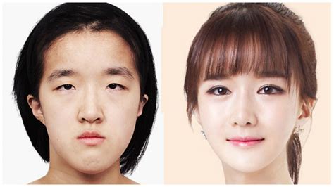 Check Out This Girls Transformation On A Korean Plastic Surgery Show