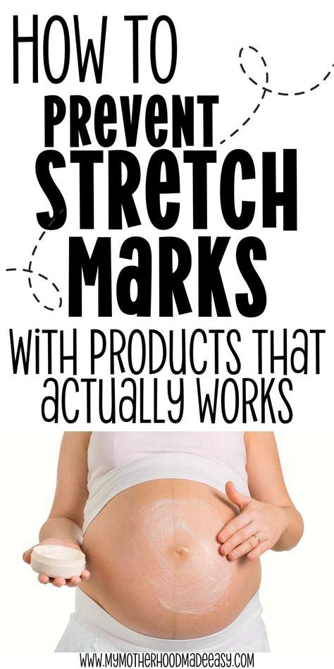 The Best Products To Prevent Stretch Marks During Pregnancy Artofit