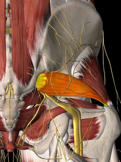 Piriformis Syndrome Specialist In Tampa Florida — Tampapainmd