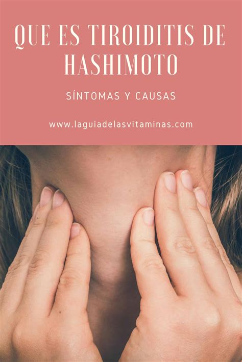Tiroiditis De Hashimoto Causas S Ntomas Y Tratamiento Esalud The Best