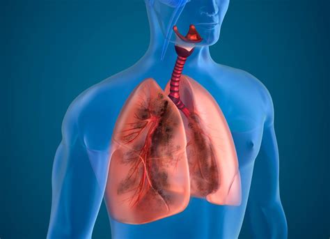 Facts About Cystic Fibrosis Health Hearty
