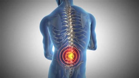 Orthopedic Services Spine Back Neck Pain Confluence Health