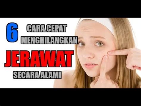 Cara menghilangkan jerawat secara alami ini juga bisa mengurangi bekas. Cara menghilangkan jerawat (jerawat batu juga) dan ...