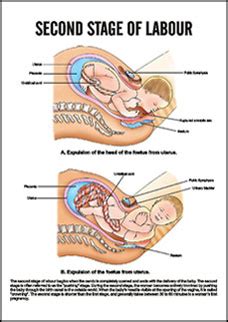 This stage begins with the full dilatation of the cervix (10c.m.) and ends with the expulsion of the fetus. Spectrum Impex :: Midwifery And Child Health Nursing ...