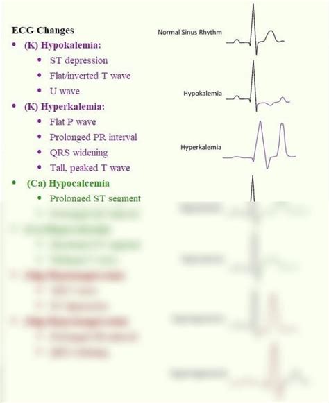 Solution Ecg Changes In Electrolyte Imbalance Studypool