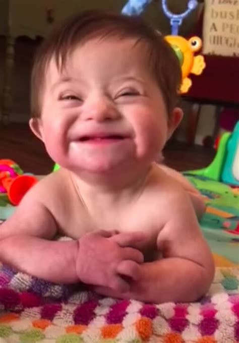 Aitaleabiamo Globalscoop News Adopted Baby Girl With Down Syndrome