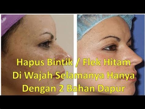 Ingat, cara ini hanya bisa dilakukan jika handphone anda adalah handphone yang mungkin untuk anda bongkar sendiri. Cara Menghilangkan Noda / Flek Hitam Di Wajah Selamanya ...