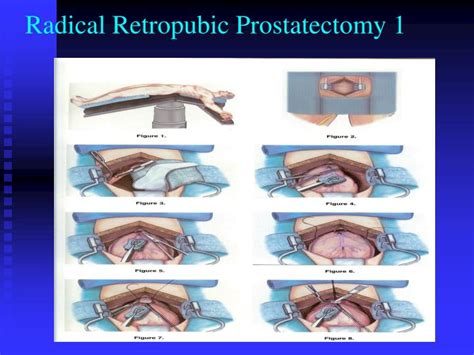 PPT Urology And Male Health PowerPoint Presentation ID
