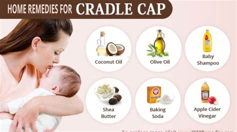 Home Remedies For Cradle Cap Cradle Cap Remedies Baby Cradle Cap
