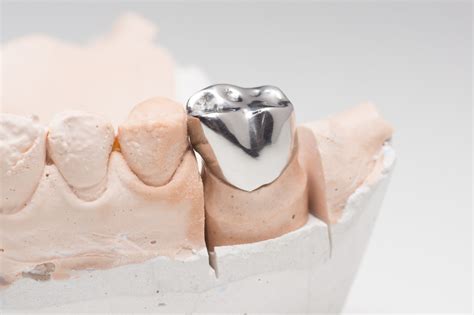 5 Benefits Of Getting Dental Crowns Katys Gentle Cosmetic Dentistry