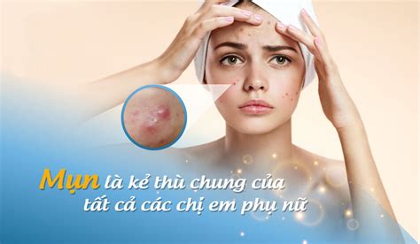 nguyên nhân gây mụn và phân loại mụn phòng khám hana