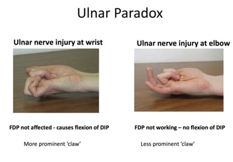 Upper Extremity Nerve Injuries Flashcards Quizlet