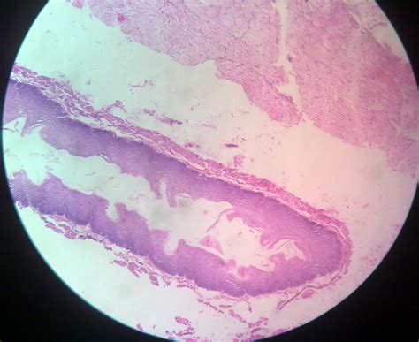 Maybe you would like to learn more about one of these? Robertson Cooked Meat Medium | howMed Images