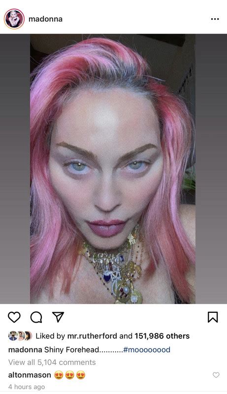 Madonna Shows Off Her Shiny Forehead In New Selfie