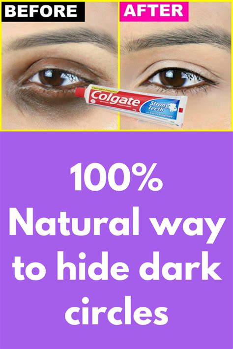 100 Natural Way To Hide Dark Circles Today I Am Going To Shae One Very