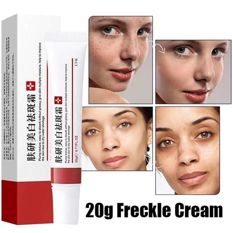 Effective Whitening Freckle Cream Remove Melasma Acne Spot Melanin Dark Spots Moisturizing Gel