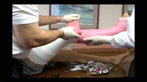 Application Long Leg Cast Fiberglass Medical Leg Cast Youtube