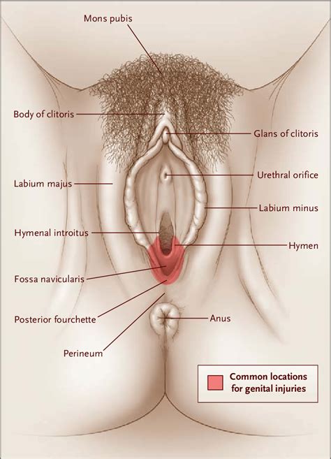 The upper region of the body includes everything above the neck, for instance, hair, scalp, eyes, ears, nose, mouth, tongue. Anatomical Sites on the External Genitalia of a Mature ...