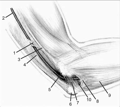 Ulnar Nerve Entrapment Elbow Mri